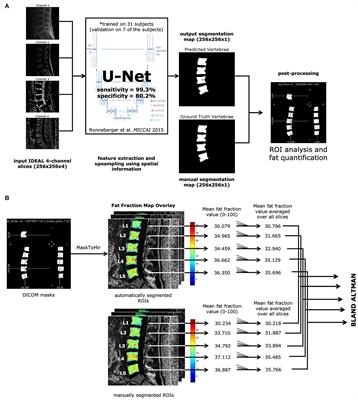 Automatic Vertebral Body Segmentation Based on Deep Learning of Dixon Images for Bone Marrow Fat Fraction Quantification